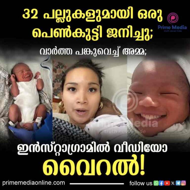 32 പല്ലുകളുമായി ഒരു പെൺകുട്ടി ജനിച്ചു; വാർത്ത പങ്കുവെച്ച് അമ്മ;!
