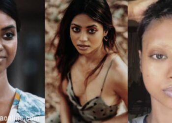 രോഗാവസ്ഥ വെളിപ്പെടുത്തി നടി ഷോൺ റോമി: തലമുടി അടക്കം കൊഴിഞ്ഞുപോകുന്ന സാഹചര്യം ആയിരുന്നു, രണ്ടാഴ്ച കൂടുമ്പോൾ സ്റ്റിറോയ്ഡ് ഇൻജക്ഷൻ